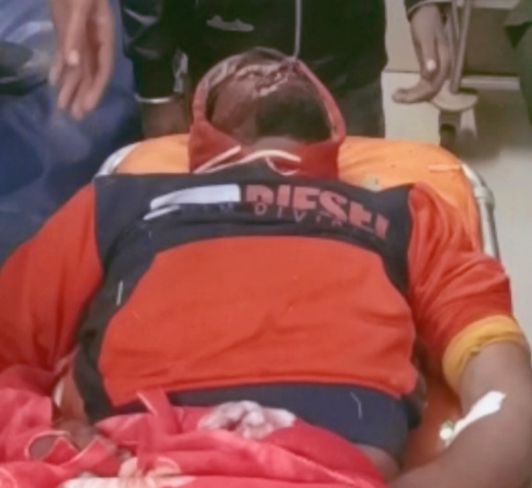 Photo of तेज़ रफ्तार पिकप ने बाइक सवार को मारी ठोकर, हादसे में घायल बाइकसवार गम्भीर रूप से हुआ घायल